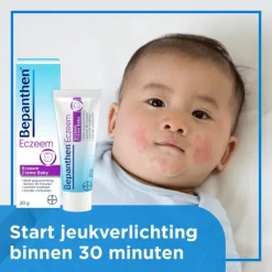 Bepanthen Eczeem Crème Baby Verlicht Jeuk En Roodheid Bij Mild Tot Matig Eczeem 20 GR