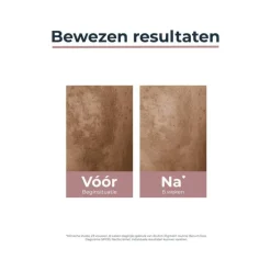 Eucerin Anti-Pigment Dagcrème SPF30 50 ML