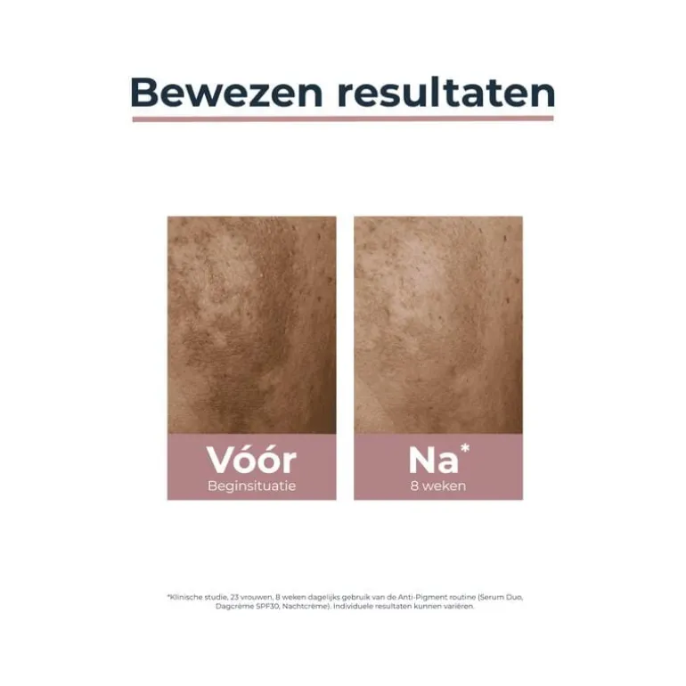 Eucerin Anti-Pigment Dagcrème SPF30 50 ML