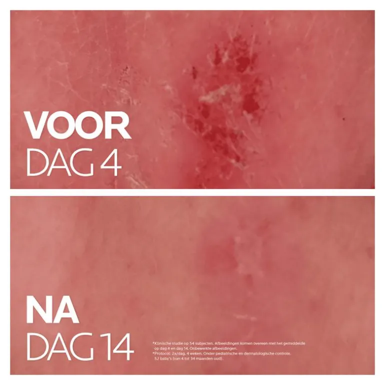 La Roche-Posay Cicaplast Balsem B5 Gevoelige Huid 40 ML