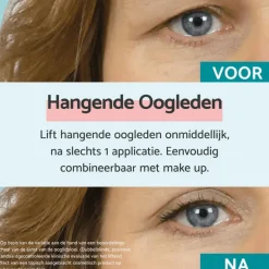 Remescar Hangende Oogleden Crème 8 ML