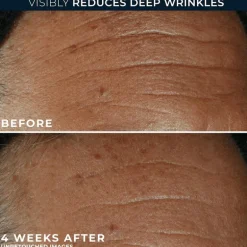 RoC Derm Correxion Fill + Treat Serum 15 ML