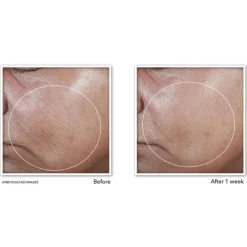 RoC Derm Correxion Firming Serum Stick