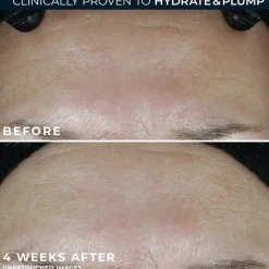 RoC Multi-Correxion Hydrate & Plump Moisturiser SPF30 50 ML