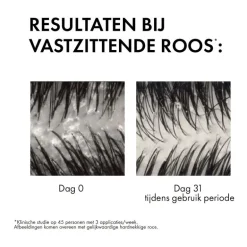 Vichy Dercos Anti-Roos Shampoo 200 ML