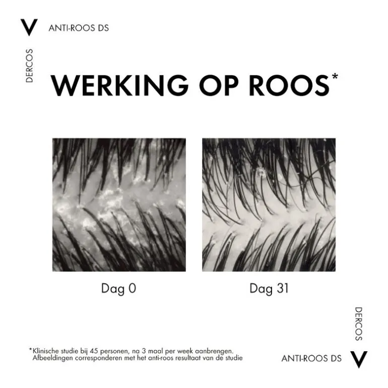 Vichy Dercos Anti-Roos Shampoo Droog Haar 200 ML