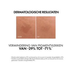 Vichy Liftactiv B3 Anti-Pigmentvlekken Serum 30 ML